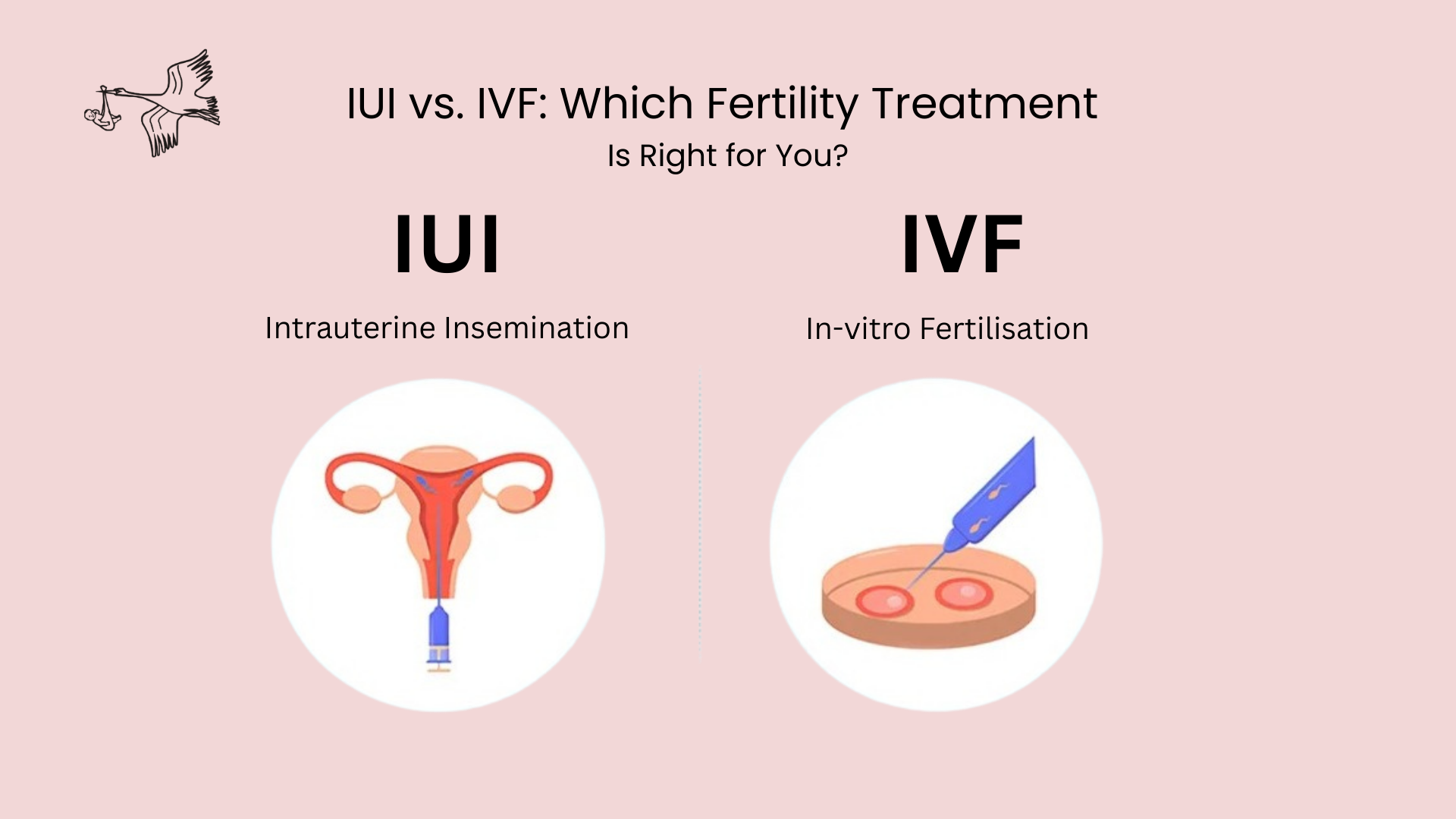 IUI vs IVF: Which Fertility Treatment Is Right for You?